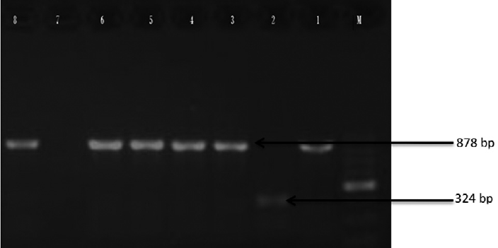 Agarose gel electrophoresis of products obtained by multiplex PCR. Lane M: 100 bp DNA ladder; L1: Positive control for blaM-1 cluster (878 bp); L2: Positive control for blaM-2 cluster (324 bp); L3: E. coli isolate positive for blaM1 gene (874 bp); L4: K. pneumoniae isolate positive for blaM1 gene (878 bp). PCR, polymerase chain reaction.