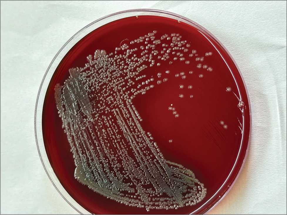 Colony of Burkholderia pseudomallei bacteria on sheep blood agar after 48 h of incubation.