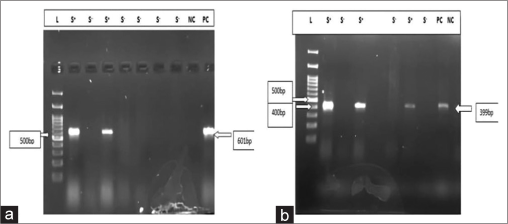 (a) Gel doc picture showing toxin A gene; Lane 1- Ladder, Lane 2- sample, Lane 3- sample, Lane 4- sample, Lane 5- sample, Lane 6- sample, Lane 7- sample, Lane 8-sample, Lane 9- negative control, and Lane 10- positive control. (b) Gel doc picture showing toxin B gene; Lane1- Ladder, Lane 2- sample, Lane 3- sample, Lane 4- sample, Lane 5- sample, Lane 6- positive control, Lane 7- sample, Lane 8- positive control, and Lane 9- negative control.