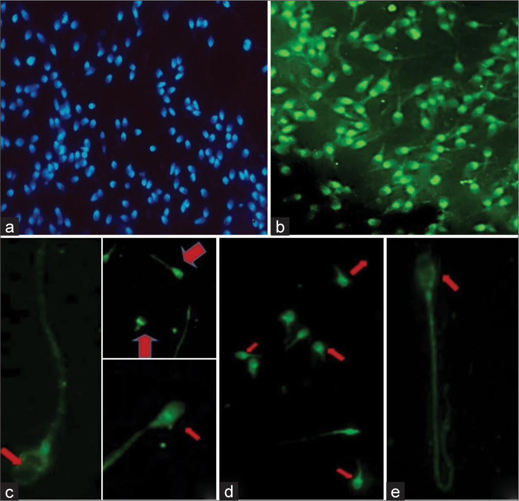 Immunofluorescence staining of sperms for phospholipase C zeta (PLC ζ). (a) 4’,6-diamidino-2-phenylindole (DAPI)-stained nuclei of sperm, (b) Sperm cells under FITC filter showing green fluorescence specific for PLC ζ, (c) Localization of PLC ζ in the equatorial region (red arrow) of sperm head, (d) Localization of PLC ζ in the post-acrosomal region of sperm head (red arrows), (e) Localization of PLC ζ in the equatorial + post-acrosomal region (red arrow) of sperm head.