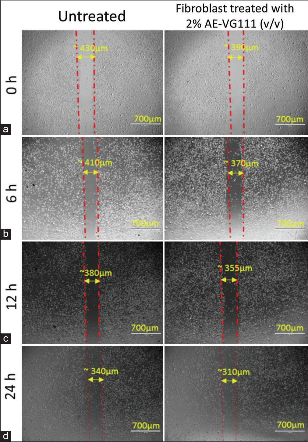 (a-d) Scratch assay: Quantitative evaluation of in vitro cell migration by phase contrast microscopy of mouse fibroblast cell line (L929) monolayers after the creation of the scratch wound and following 0, 6, 12 and 24 h exposure to the 2% AE-VG111 (v/v) treatment. Scratch assay: Quantitative evaluation of in vitro cell migration by phase contrast microscopy of mouse fibroblast cell line (L929) monolayers after the creation of the scratch wound and following 0, 6, 12 and 24 h exposure to the 2% AE-VG111 (v/v) treatment. AE-VG111: Aqueous extract of VG111.
