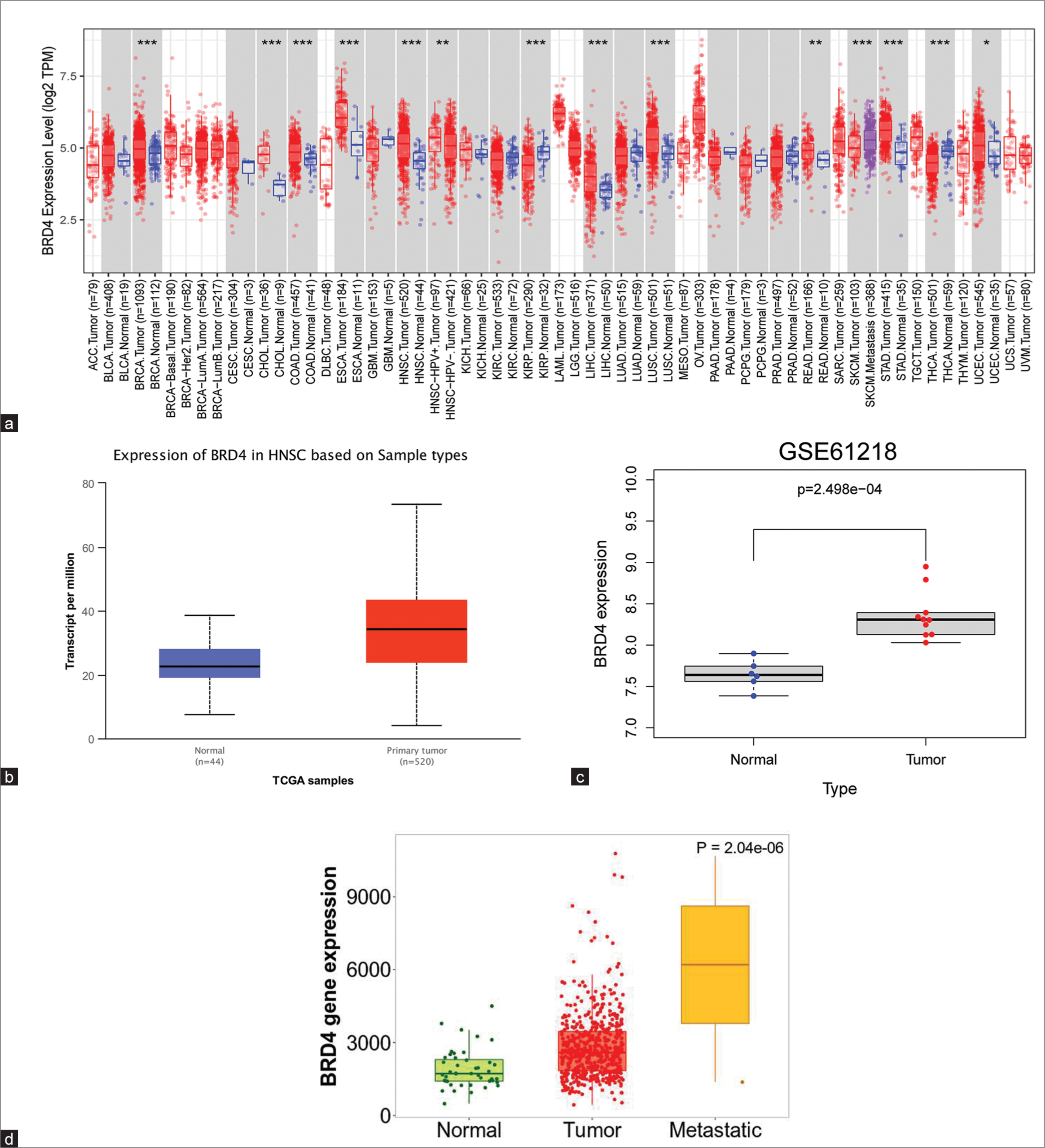 Expression of bromodomain-containing 4 (BRD4) in head-and-neck cancer (HNC)/nasopharyngeal carcinoma (NPC). (a) BRD4 gene expression in pancreatic cancer was assessed using the cancer genome atlas database cohorts. (b) BRD4 expression was significantly higher in HNC tissues than in normal tissues (P < 0.05). (c) BRD4 expression was upregulated in NPC (P < 0.05). (d) The expression of BRD4 in metastatic tissues of HNC was significantly higher compared to primary tumor tissues and normal tissues (P < 0.05). *P < 0.05; **P < 0.01; ***P < 0.001. TPM: Transcripts per million, HNSC: Head and neck squamous carcinoma, TCGA: The cancer genome atlas.