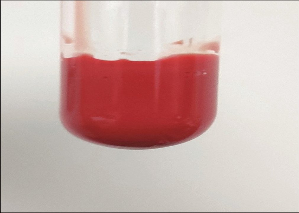 Vacutainer with cherry red blood sample sent for complete blood count analysis.