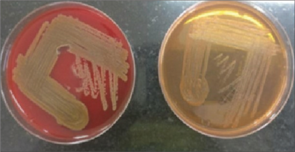 Illustrates the yellow-orange pigment production of the Chryseobacterium indologenes isolate. The colonies on sheep blood agar exhibited a distinct yellow coloration, measuring approximately 2-3 mm in diameter. This characteristic pigment production is a key identifying feature of Chryseobacterium indologenes.