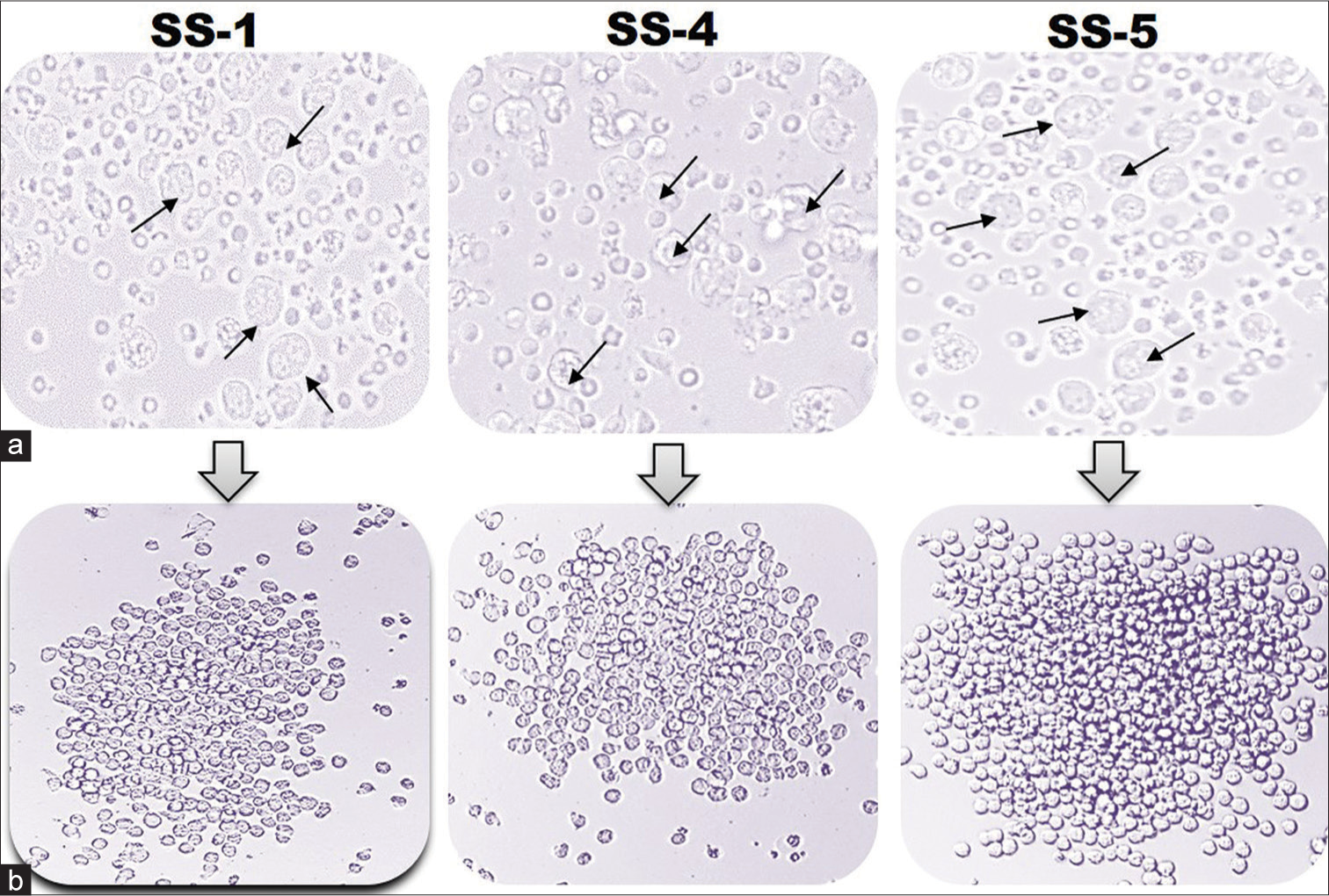 A representative diagram of hybridomas clones. (a) Presence of hybridoma clones after HAT selection. The photographs were taken at ×400 magnification using an inverted microscope. (b) Progression of hybridomas in cRPMI medium. The image was taken at ×200 using an inverted microscope. Black arrow indicates the survived hybridoma clones.