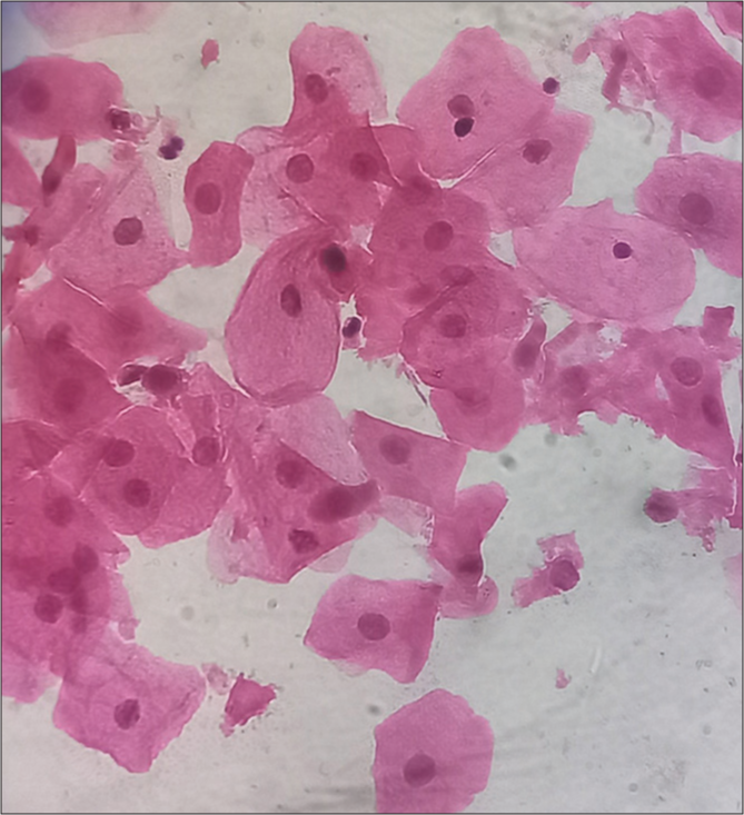 Predominantly Intermediate cells, hematoxylin, and eosin (H&E) stain, 40x.