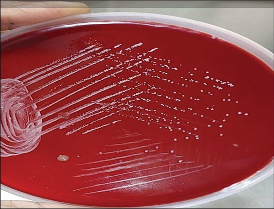 Chalky white, tough colonies grown in blood agar.