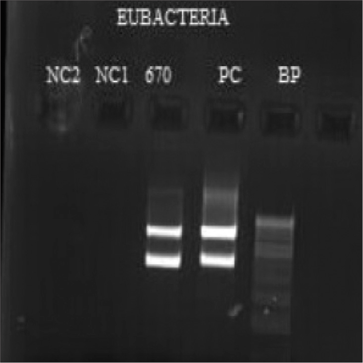 Gel electrophoresis image of the amplicon of bacterial genome targeting 16S ribosomal RNA region.