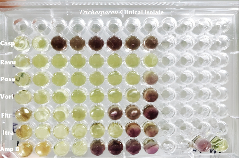 Antifungal susceptibility testing – MTT (3-(4, 5-dimethyl-2-thiazolyl)-2, 5-diphenyl- 2H-tetrazoliumbromide) assay. Casp: Caspofungin, Ravu: Ravuconazole, Posa: Posaconazole, Vori: Voriconazole, Flu: Fluconazole, Itra: Itraconazole, Amp B: Amphotericin B. Reddish pink wells indicate turbidity with viable fungi. Rest of the wells are not turbid with the absence of viable fungi.