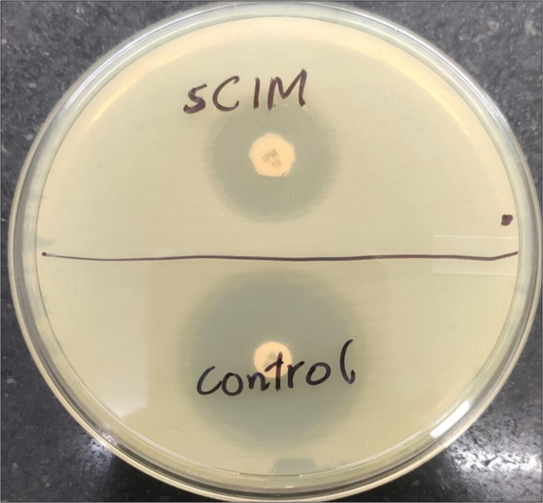 Visualization of simplified carbapenem inactivation method testing of carbapenem-resistant Enterobacterales isolate: Imipenem disc (10 μg) with test strain smearing alongside the control disc with no bacterial smearing (for comparative analysis). sCIM: Simplified carbapenem inactivation method