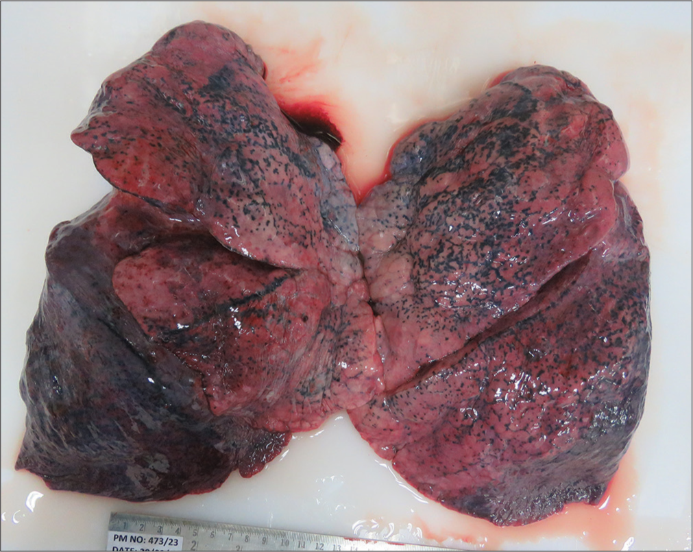 Edematous, congested, and consolidated lungs.