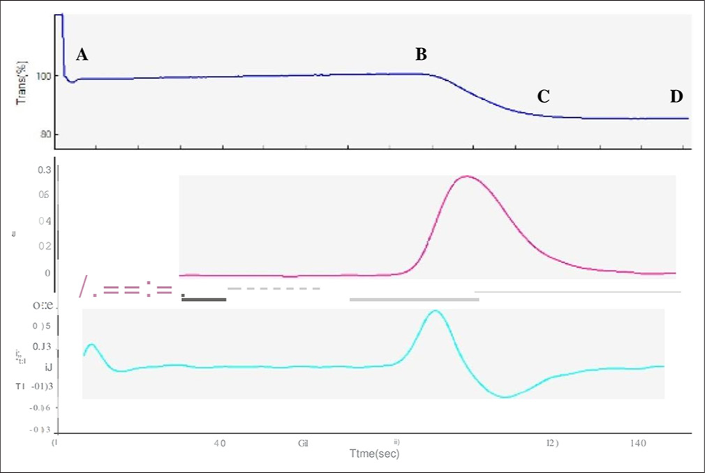 Activated partial thromboplastin time (APTT) clot waveform - Weak clot formation pattern - 55-year-old female patient with clinical diagnosis of sepsis and prolonged APTT (44 s). The liver function tests were deranged with increased liver enzymes. (A–B) The transmittance wave (top most graph) revealed marked prolongation of both pre-coagulation and (B–D) coagulation phase. Blue graph- Transmittance wave form, Purple graph- First derivative curve, Green graph -Second derivative curve