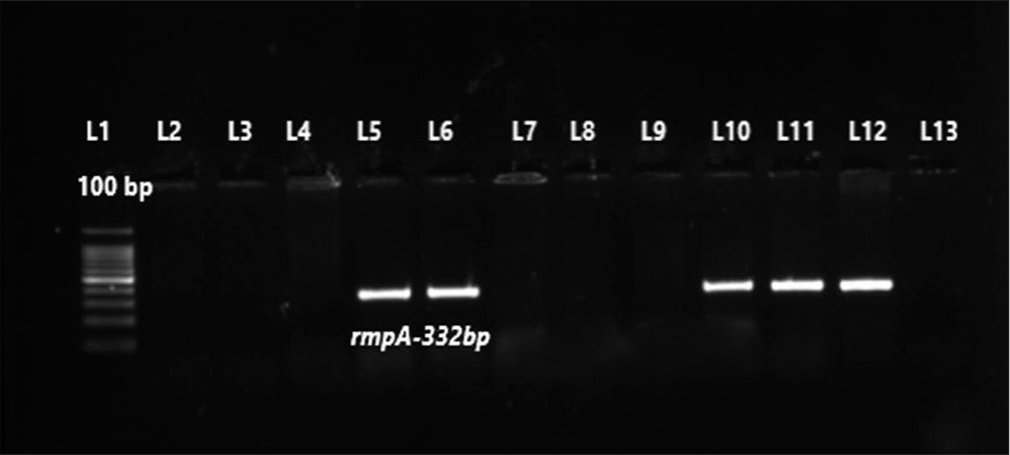 Gel picture of uniplex polymerase chain reaction for rmpA gene. Lane-1 (L1) – 100 bp molecular marker; L2-L4 and L7- L9 – test isolates negative for rmpA; L5, L6, L10 and L11 – test isolates were positive for rmpA gene (332 bp); L12-Positive control for rmpA gene (332 bp); L13-Negative control.